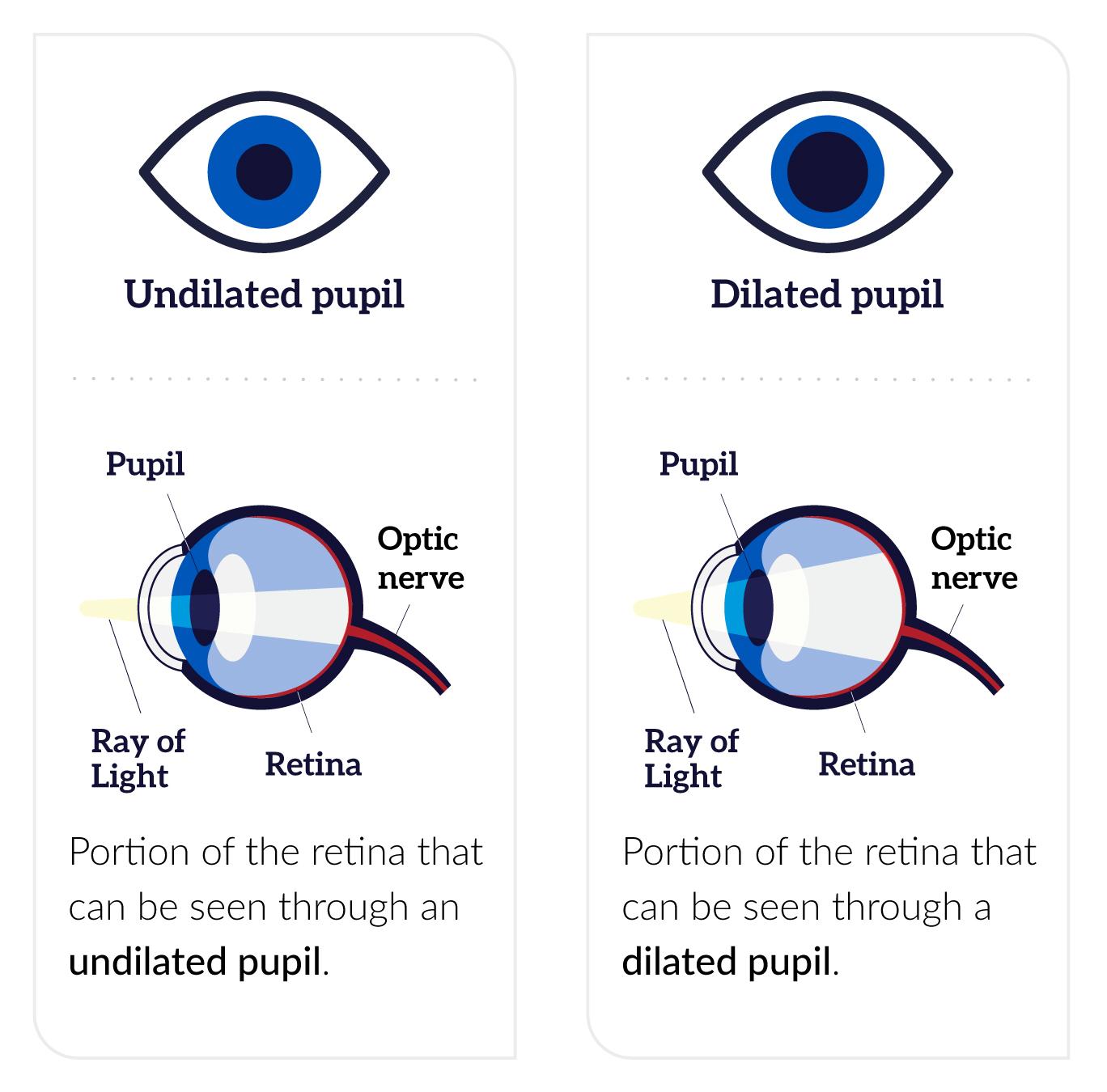 eye pupil size chart