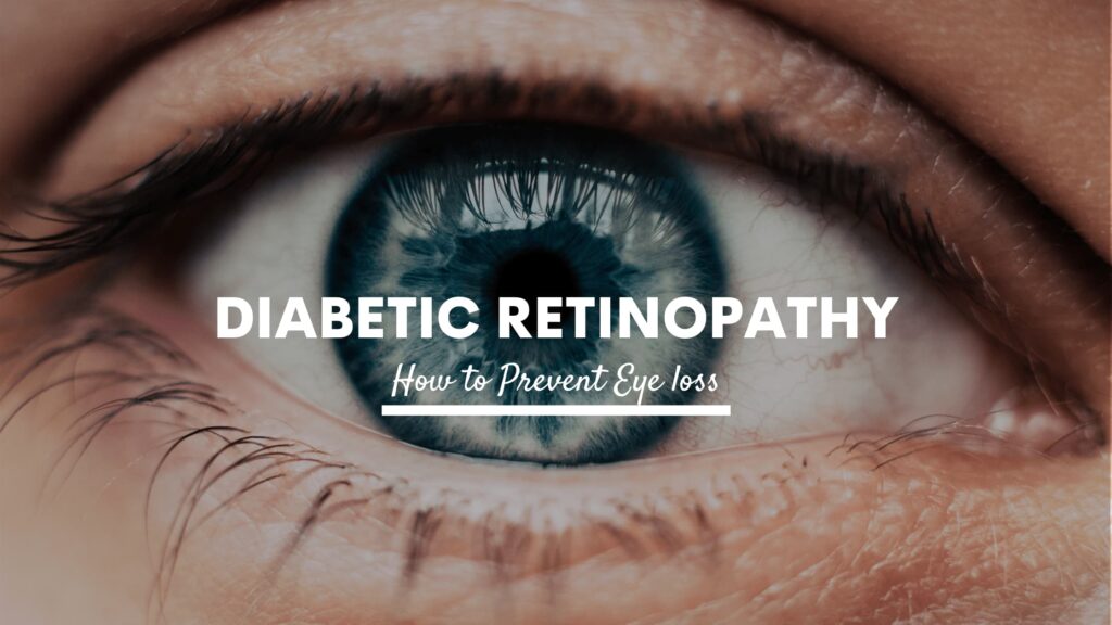 Diabetic Retinopathy Causes Signs And Treatment Chadderton Opticians