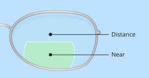 D segmented bifocal lens